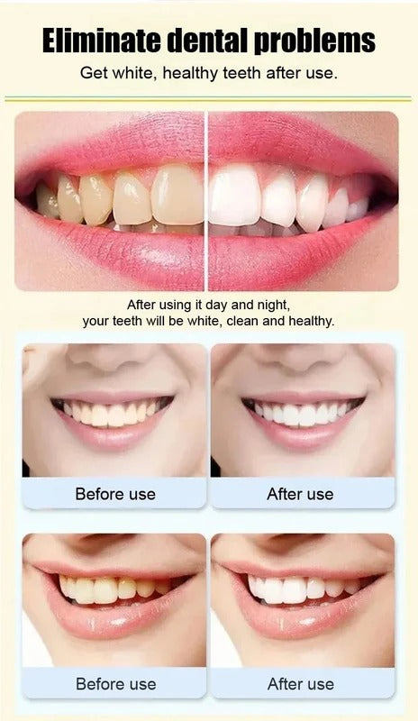 Probiotic Whitening Toothpaste (Pack of 2)